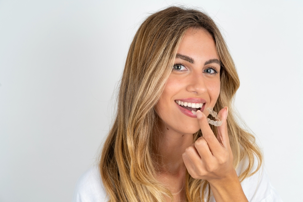 Invisalign Kenwood